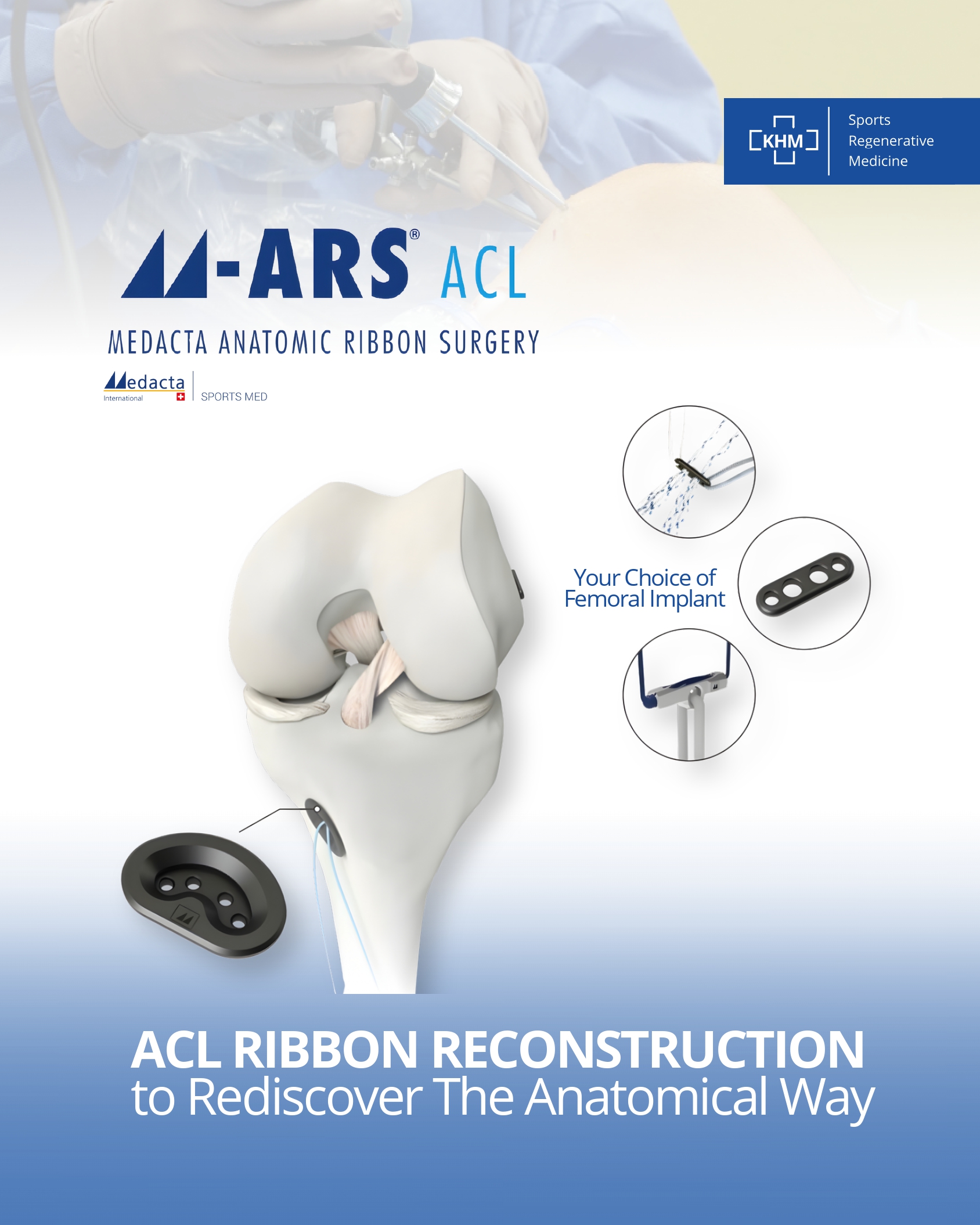 M-ARS ACL